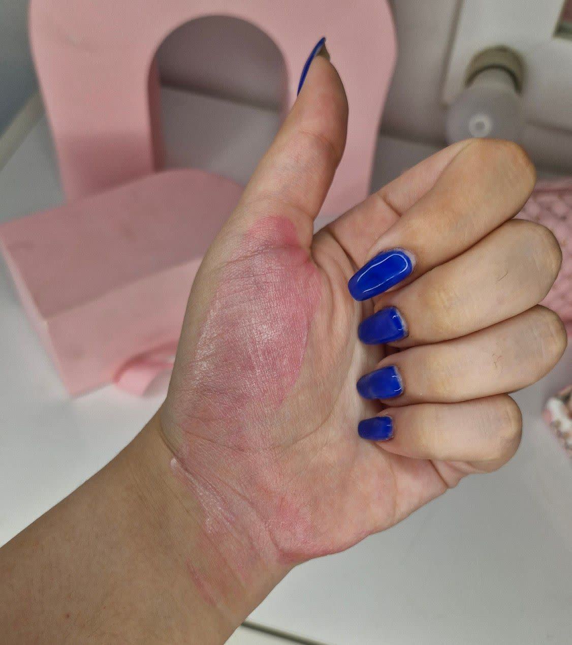 تست رژگونه حرارتی