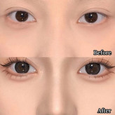 کانتور بینی کانتور استیکی