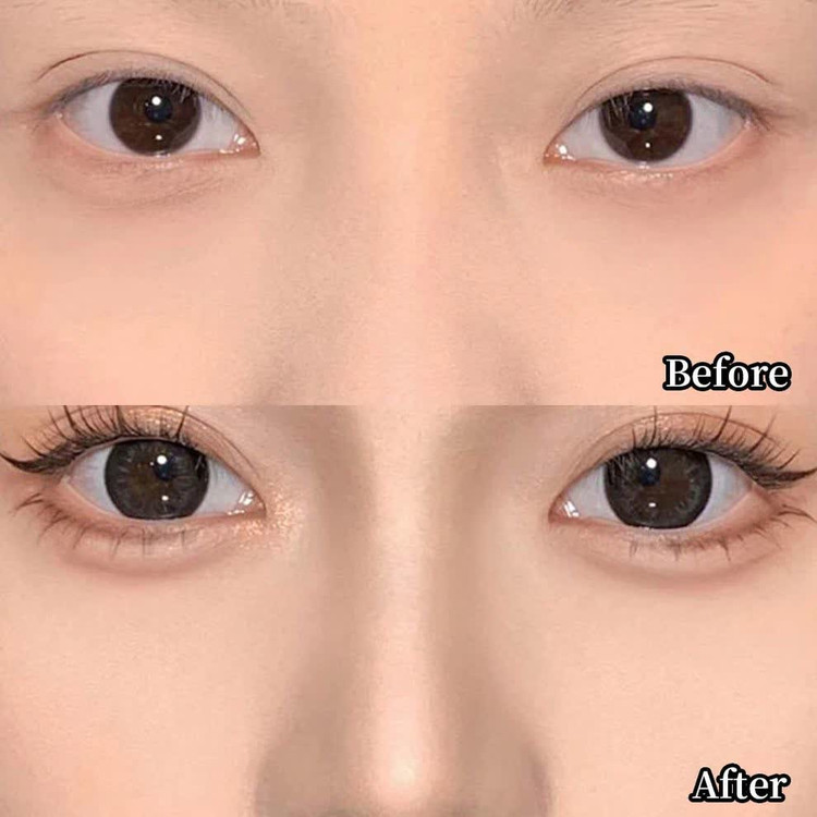 کانتور بینی کانتور استیکی